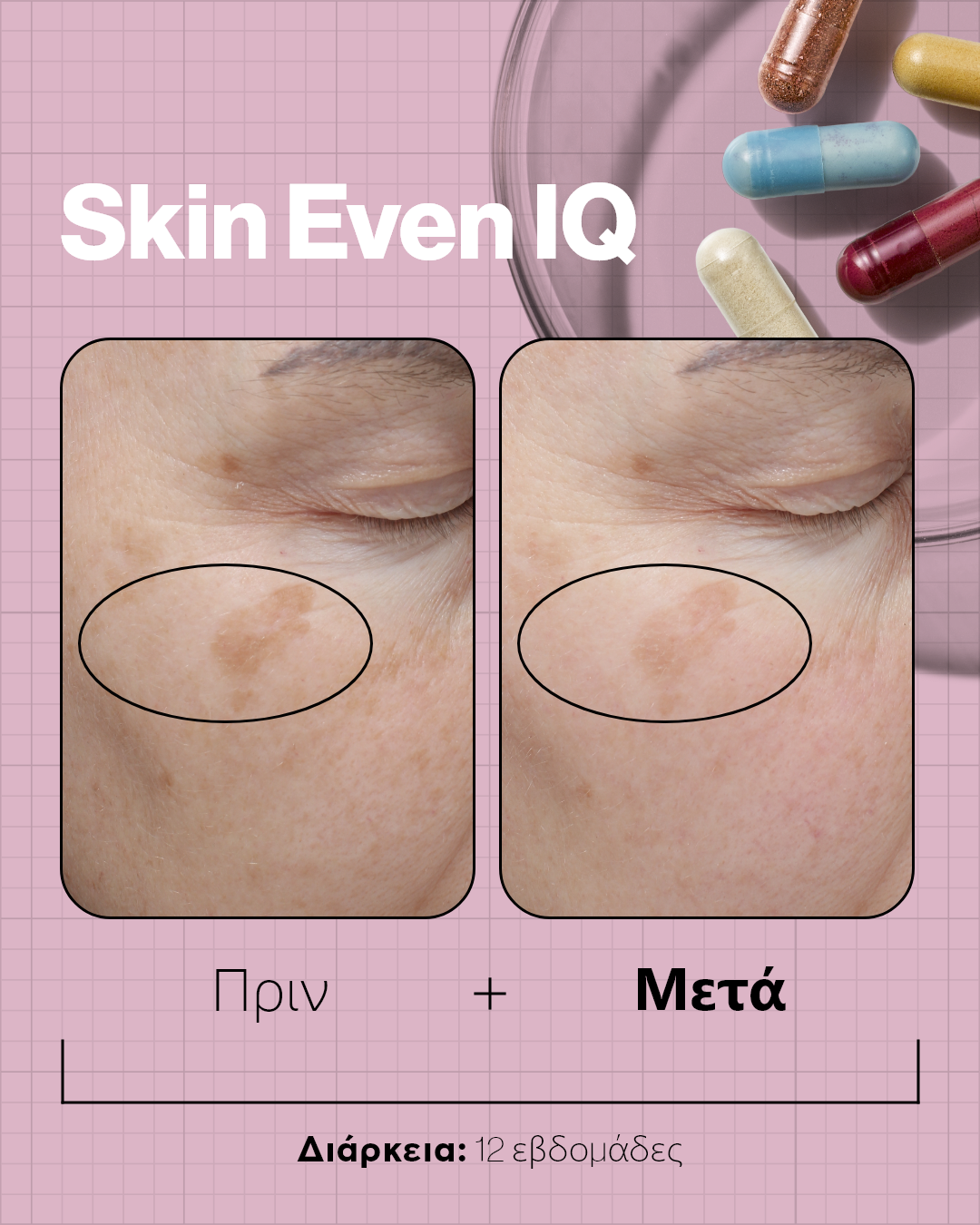 Advanced Nutrition Programme Skin Even IQ