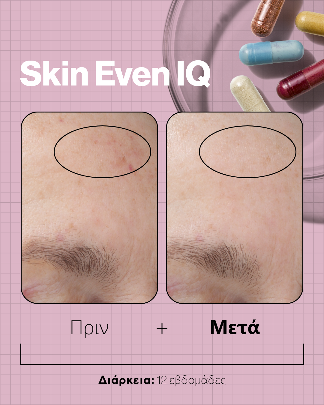 Advanced Nutrition Programme Skin Even IQ