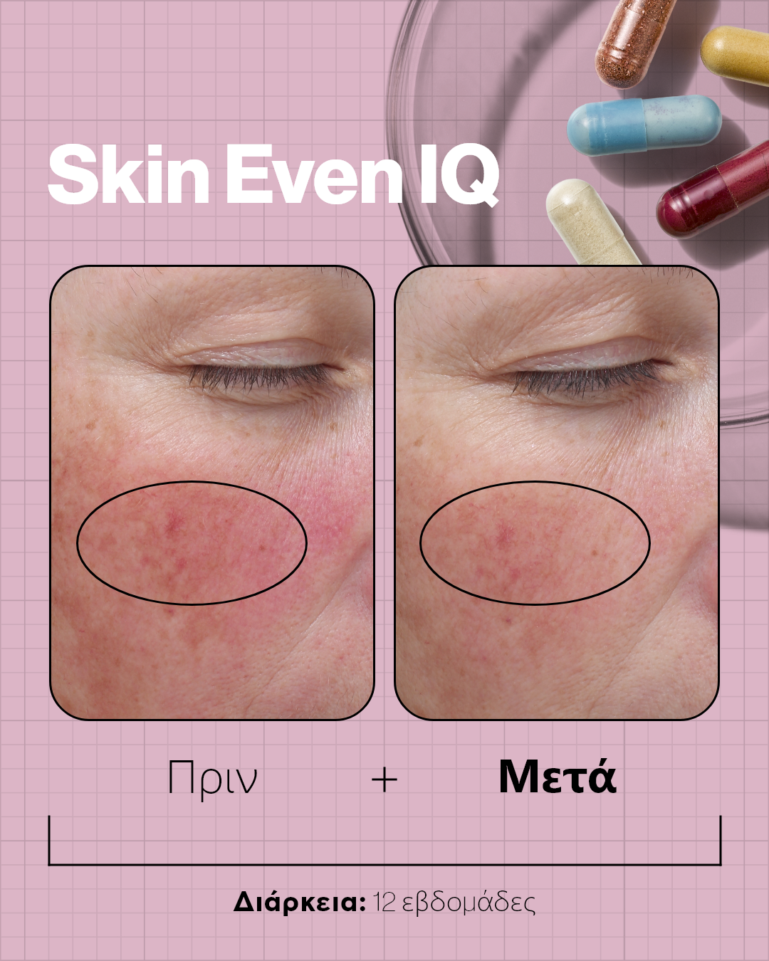 Advanced Nutrition Programme Skin Even IQ