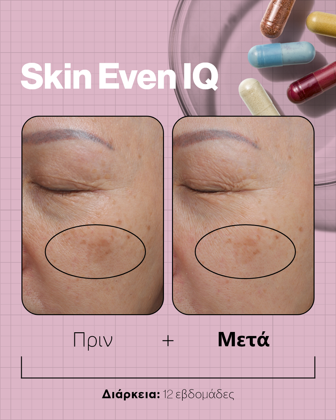 Advanced Nutrition Programme Skin Even IQ