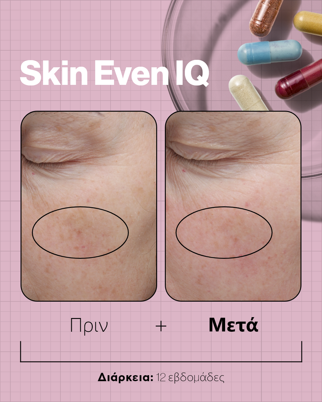 Advanced Nutrition Programme Skin Even IQ