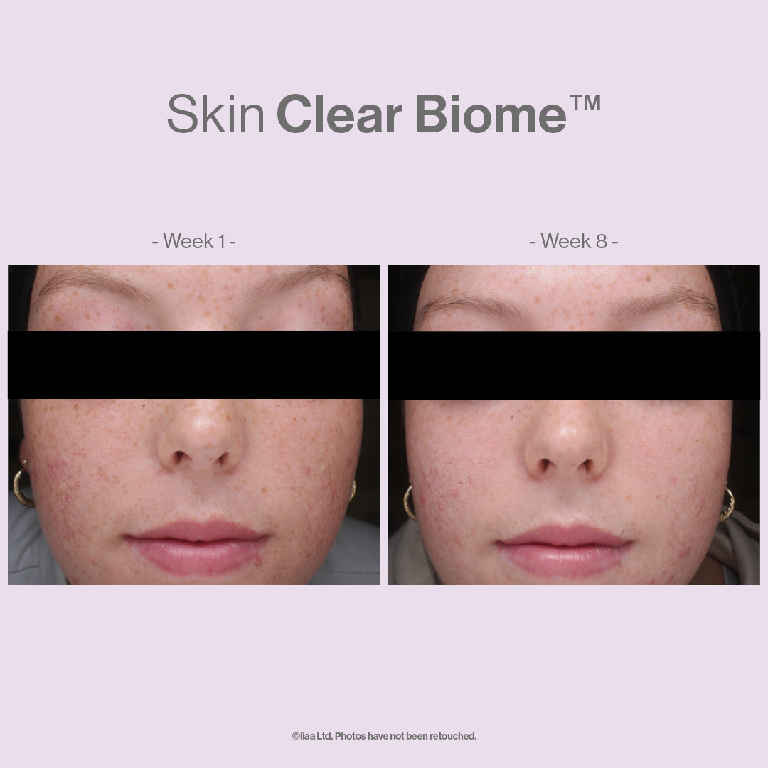 Advanced Nutrition Programme™ Skin Clear Biome™