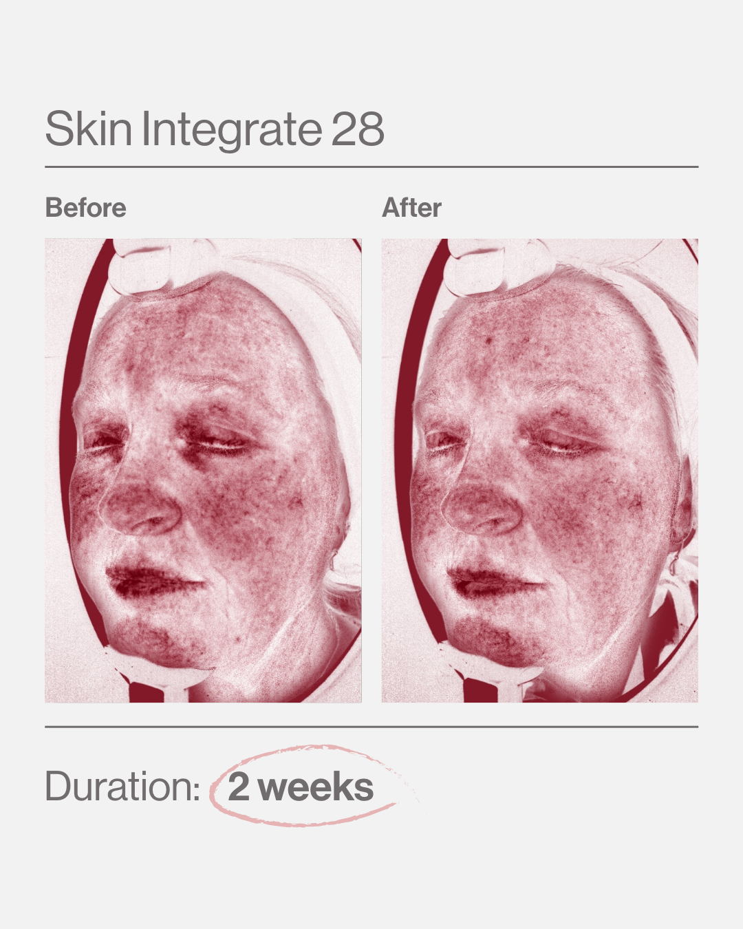 Skin Intergate 28