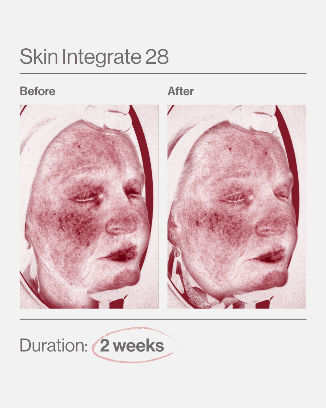 Skin Intergate 28